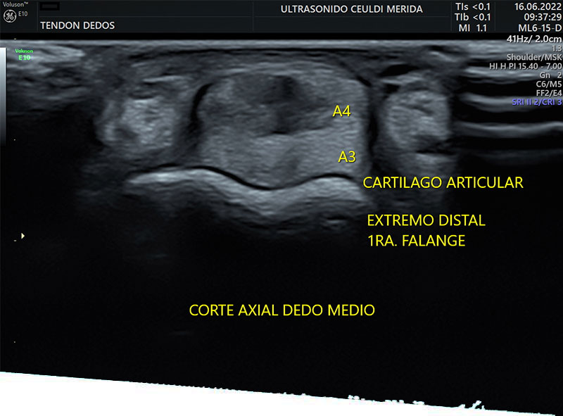 Ultrasonido musculoesquelético en Mérida - Ultrasonido Musculoesquelético en Mérida