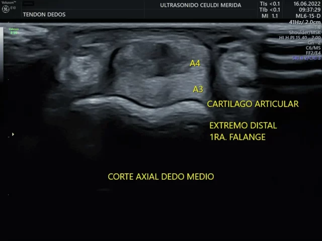 Ultrasonido MSK en Mérida